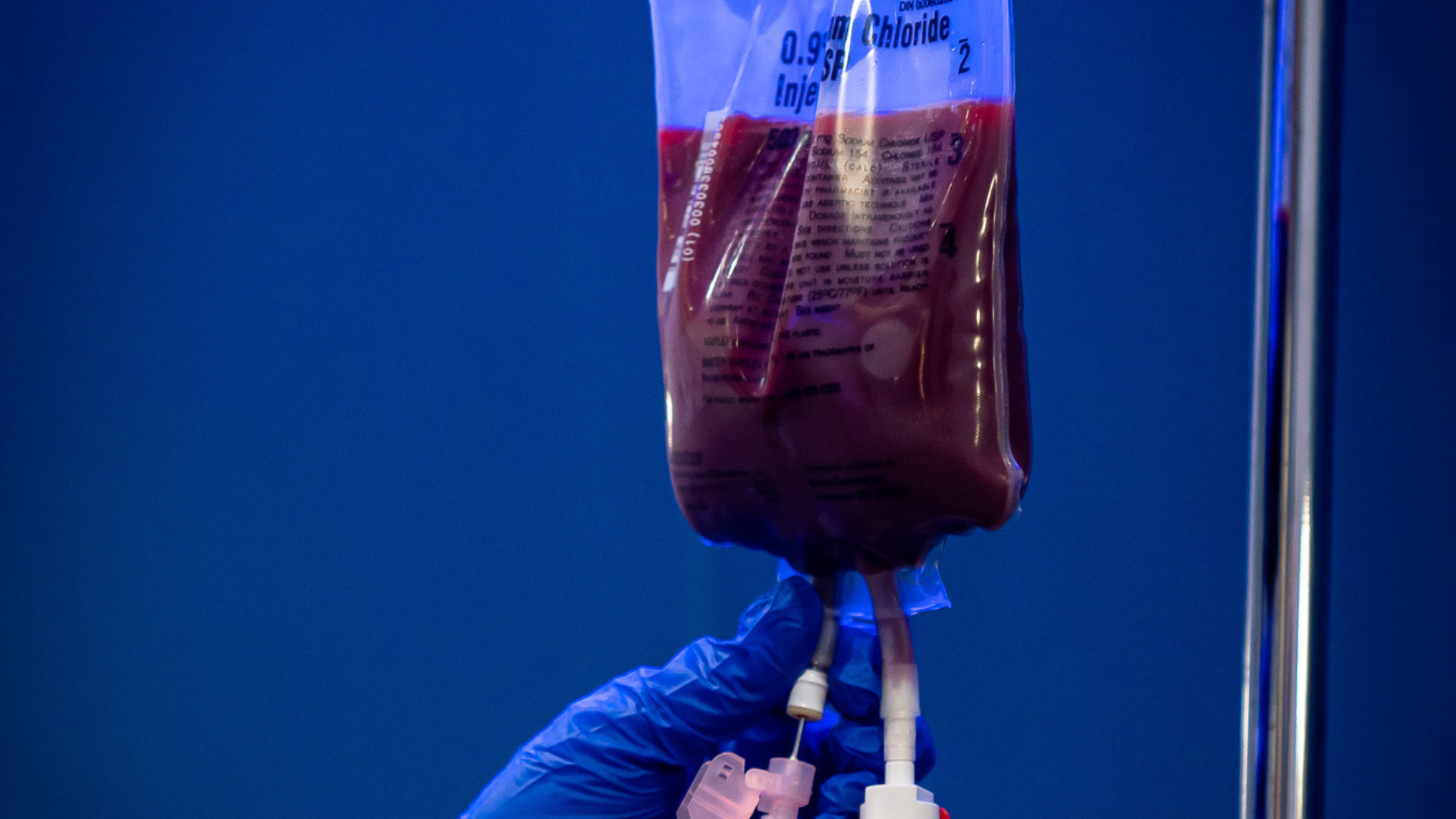 Ozone UV IV therapy treatment for immune system support